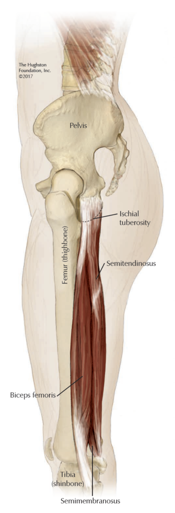 Hamstring Surgery