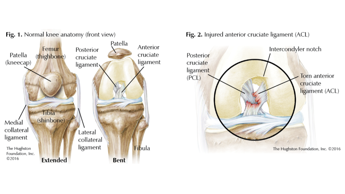 Normal knee anatomy and ACL tear