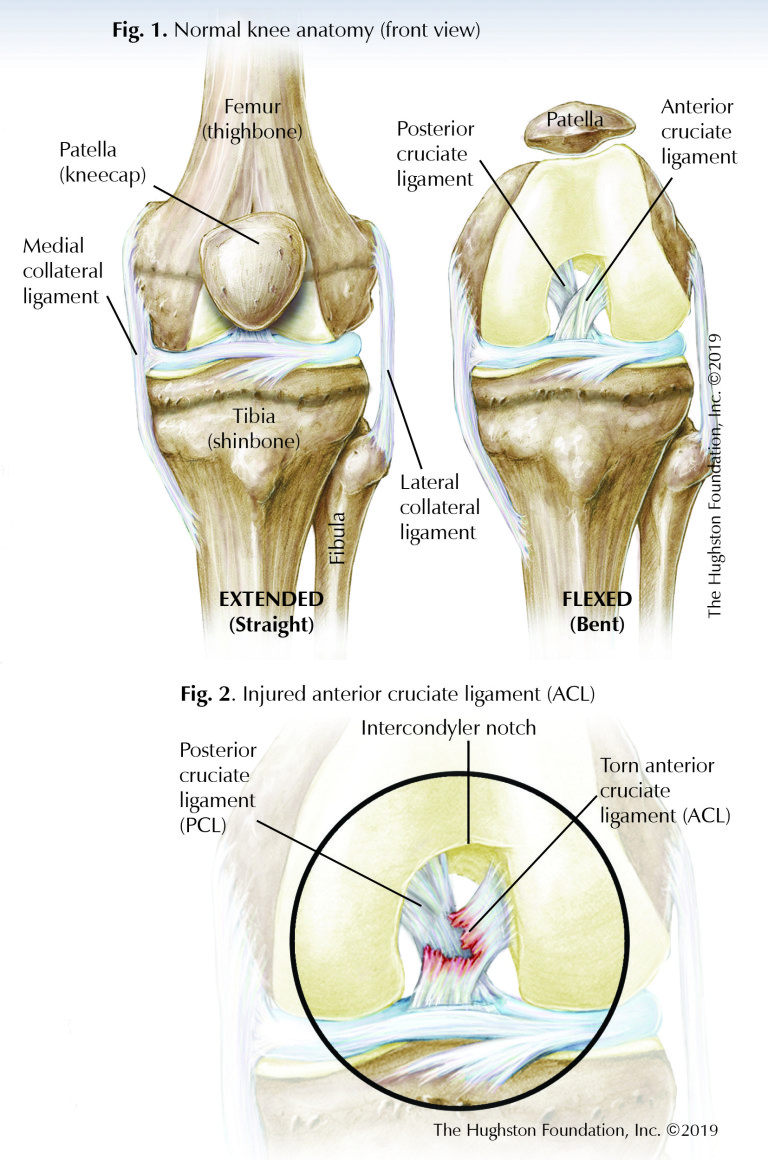 Hamstring Injuries - Hughston Clinic