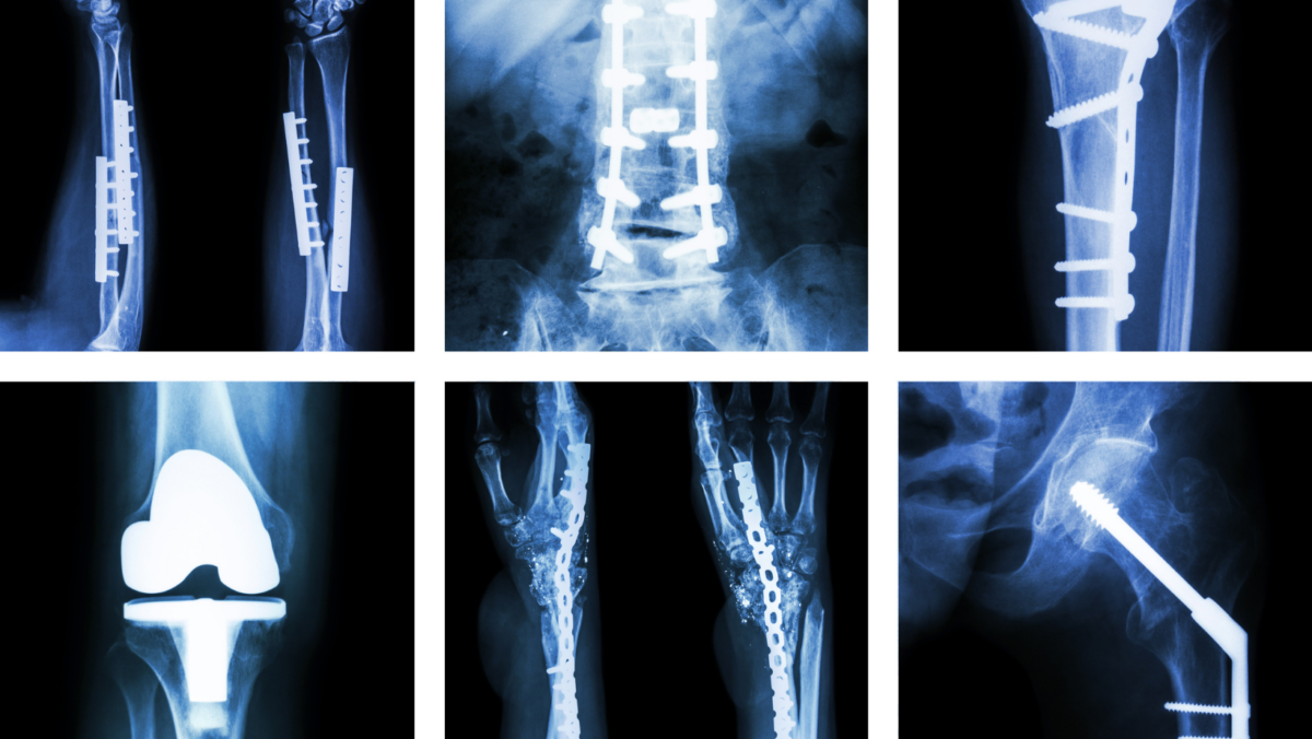 Orthopedic Imaging