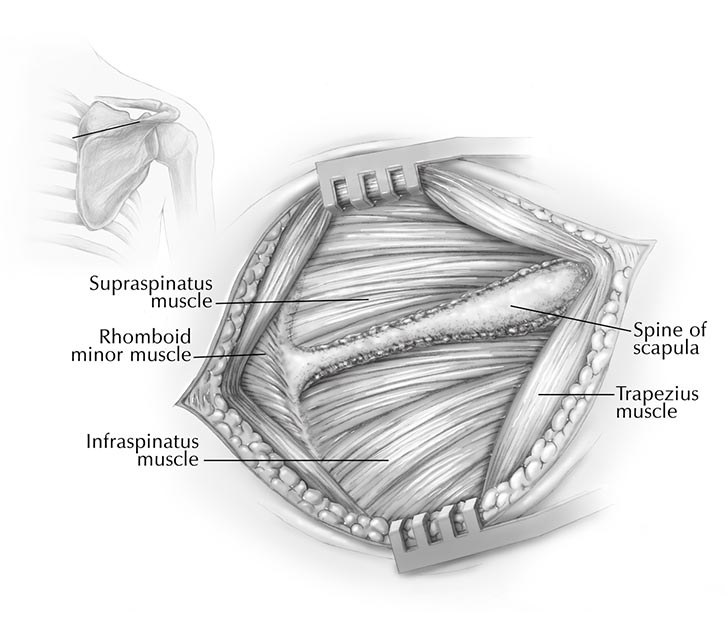 Medical Illustration