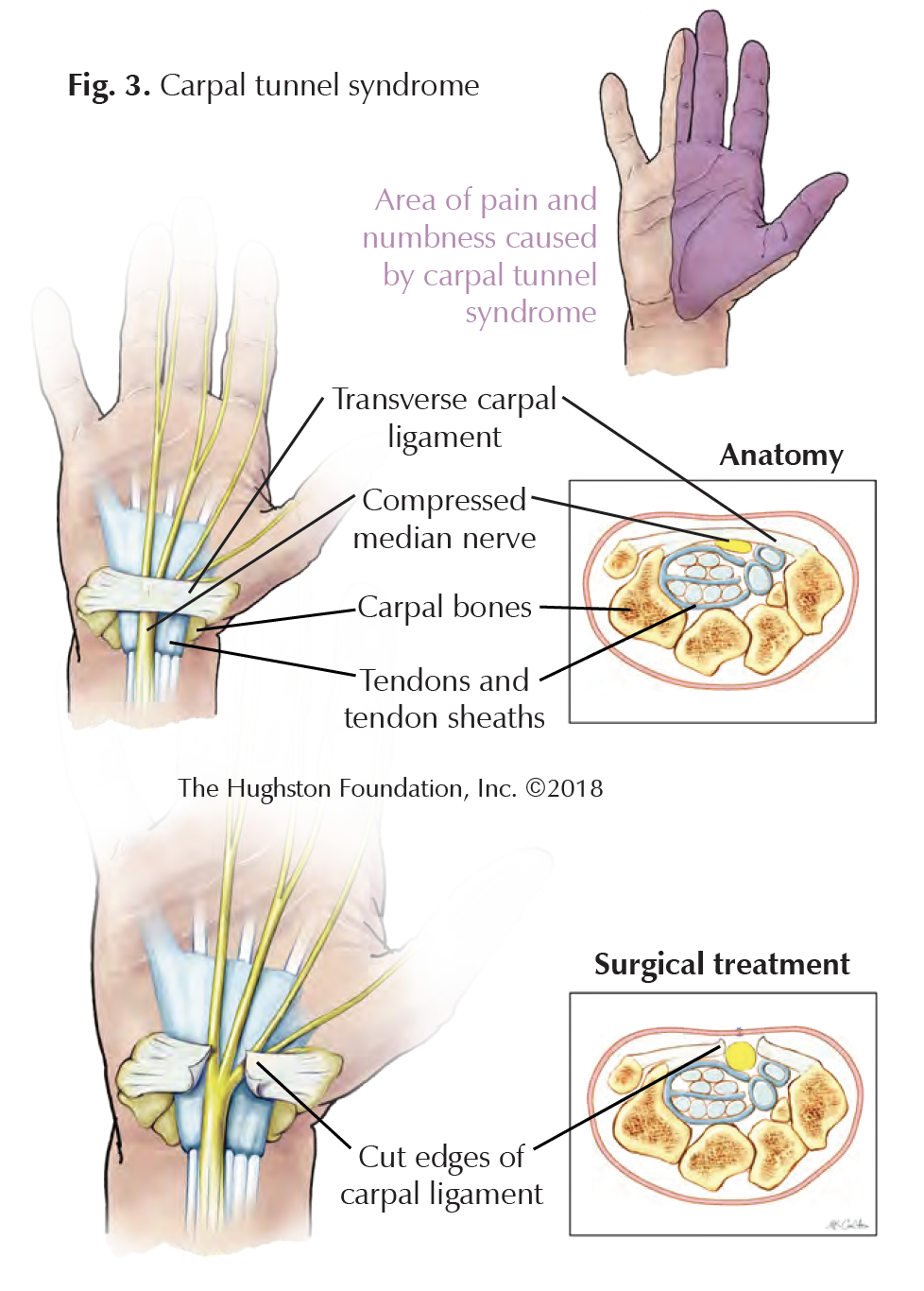 New Developments in Hand Surgery Hughston Clinic