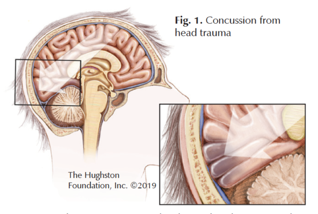 Ice Skating Injuries - Hughston Clinic