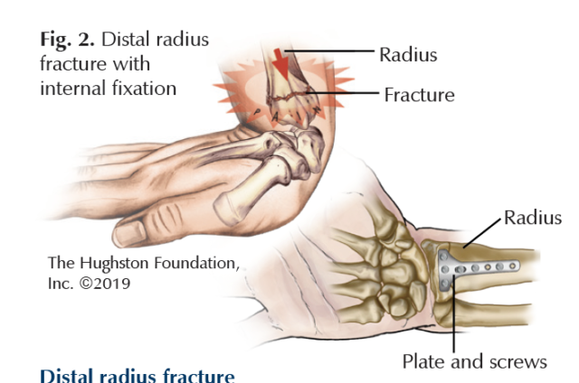 Ice Skating Injuries - Hughston Clinic