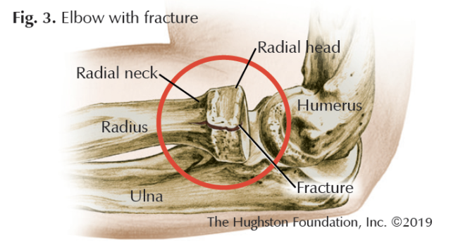 Ice Skating Injuries - Hughston Clinic