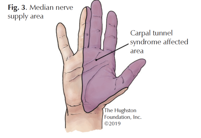 Carpal Tunnel Syndrome Symptoms - Chester County Hospital