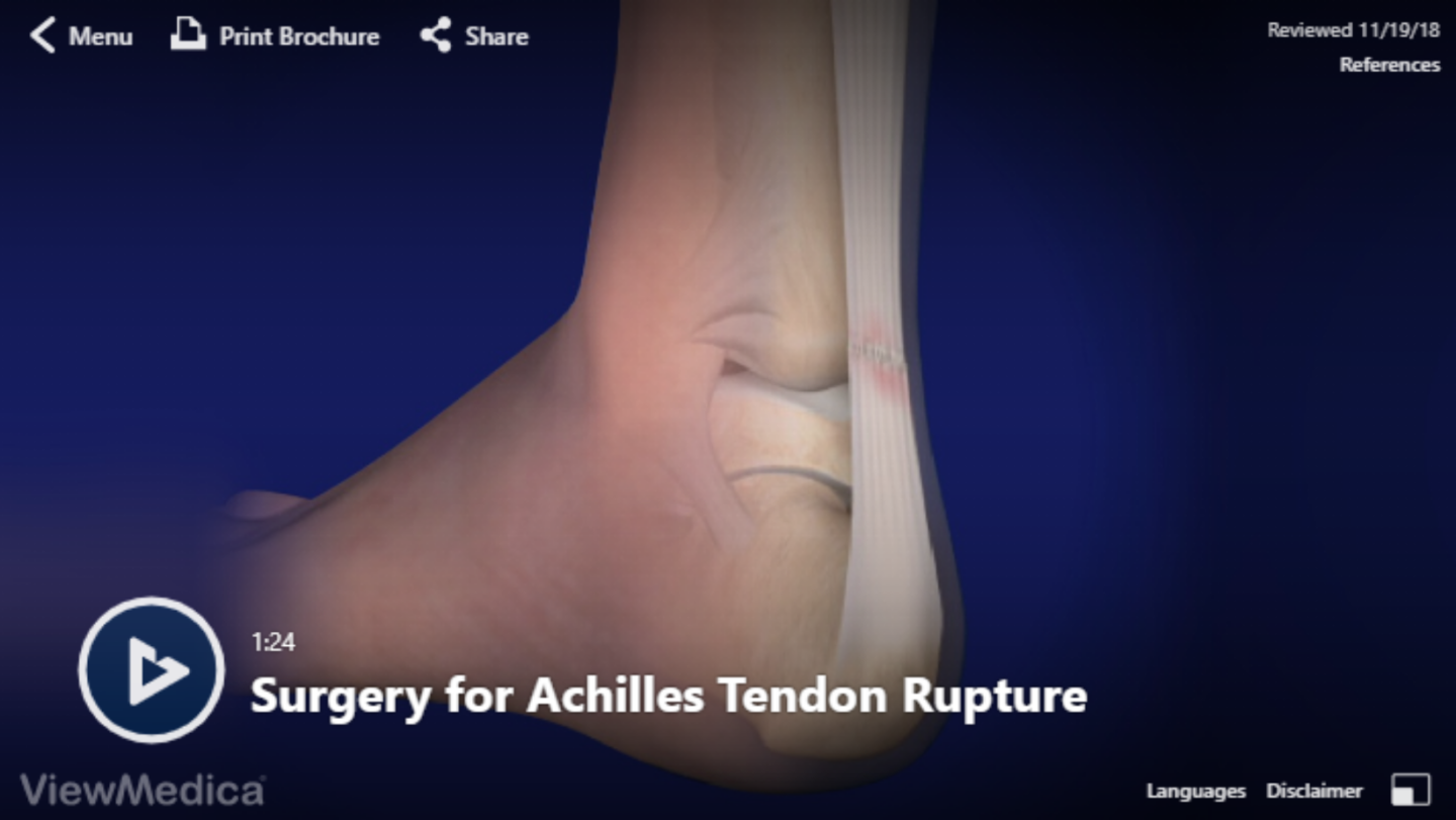 Video: Surgery For Achilles Tendon Rupture - Hughston Clinic