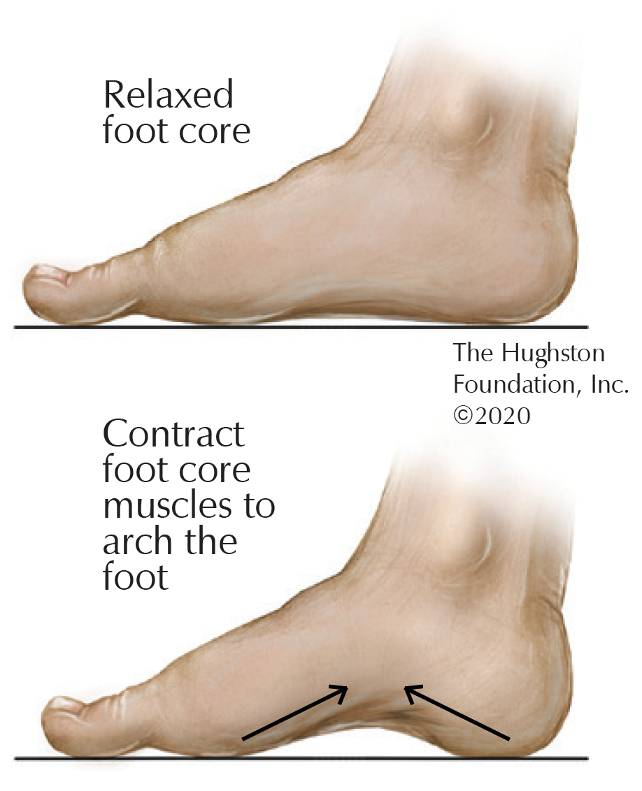 Fallen Arches Hughston Clinic