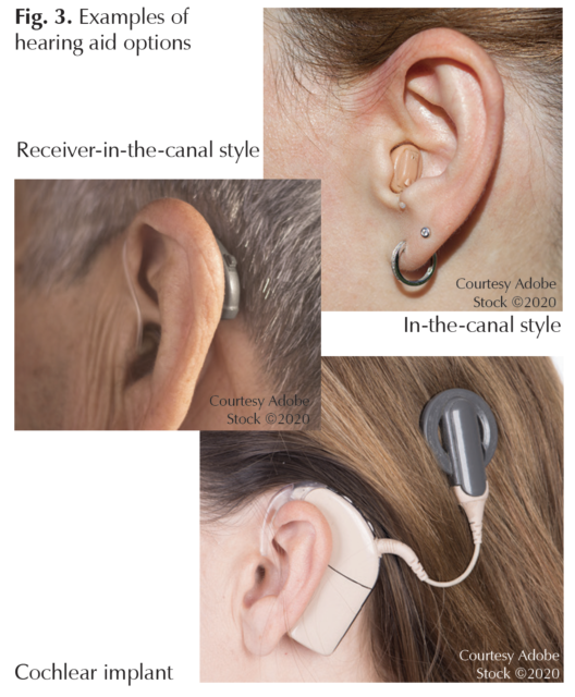 Does Using A Hearing Aid Weaken Your Real Hearing? - Clifton