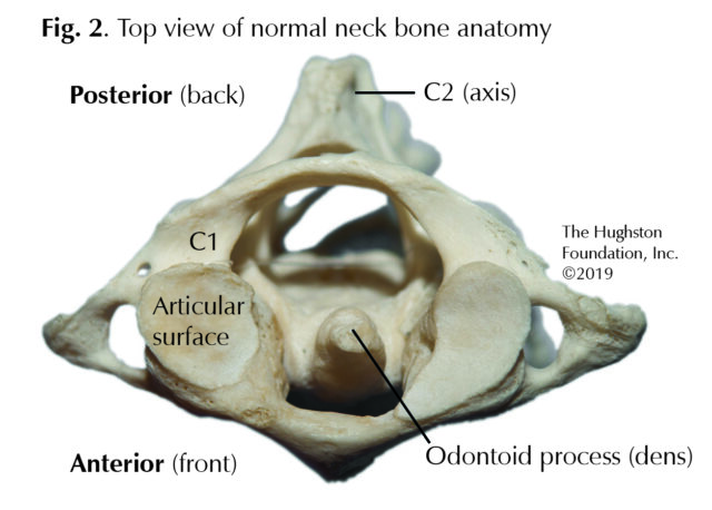 axis bone diagram