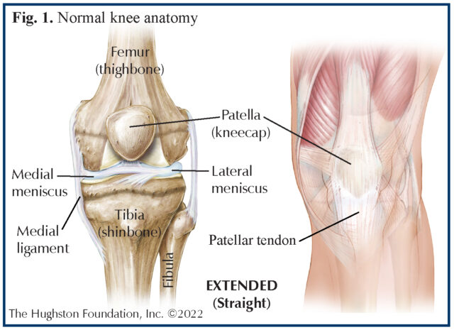 Hamstring Injuries - Hughston Clinic