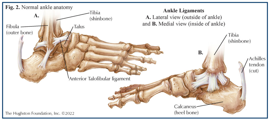 Pectoralis Major Muscle Injuries - Hughston Clinic