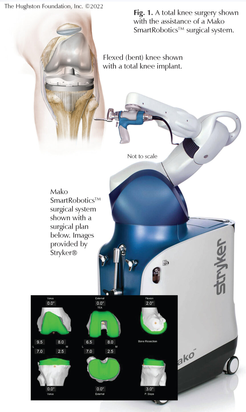 Robotic Total Knee Replacement: Questions For A Specialist - Hughston ...