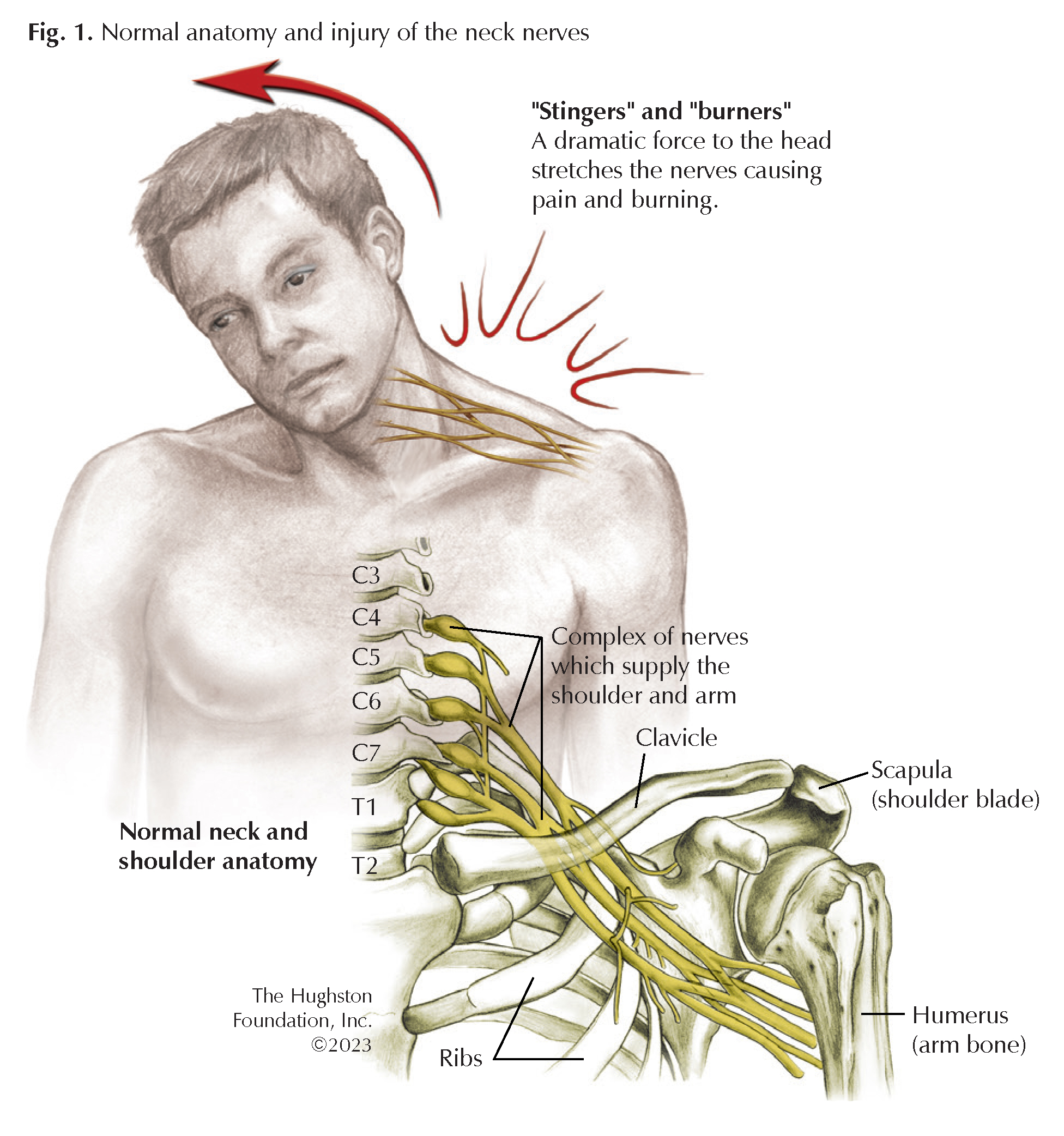 can-a-pinched-nerve-cause-headaches-and-neck-pain