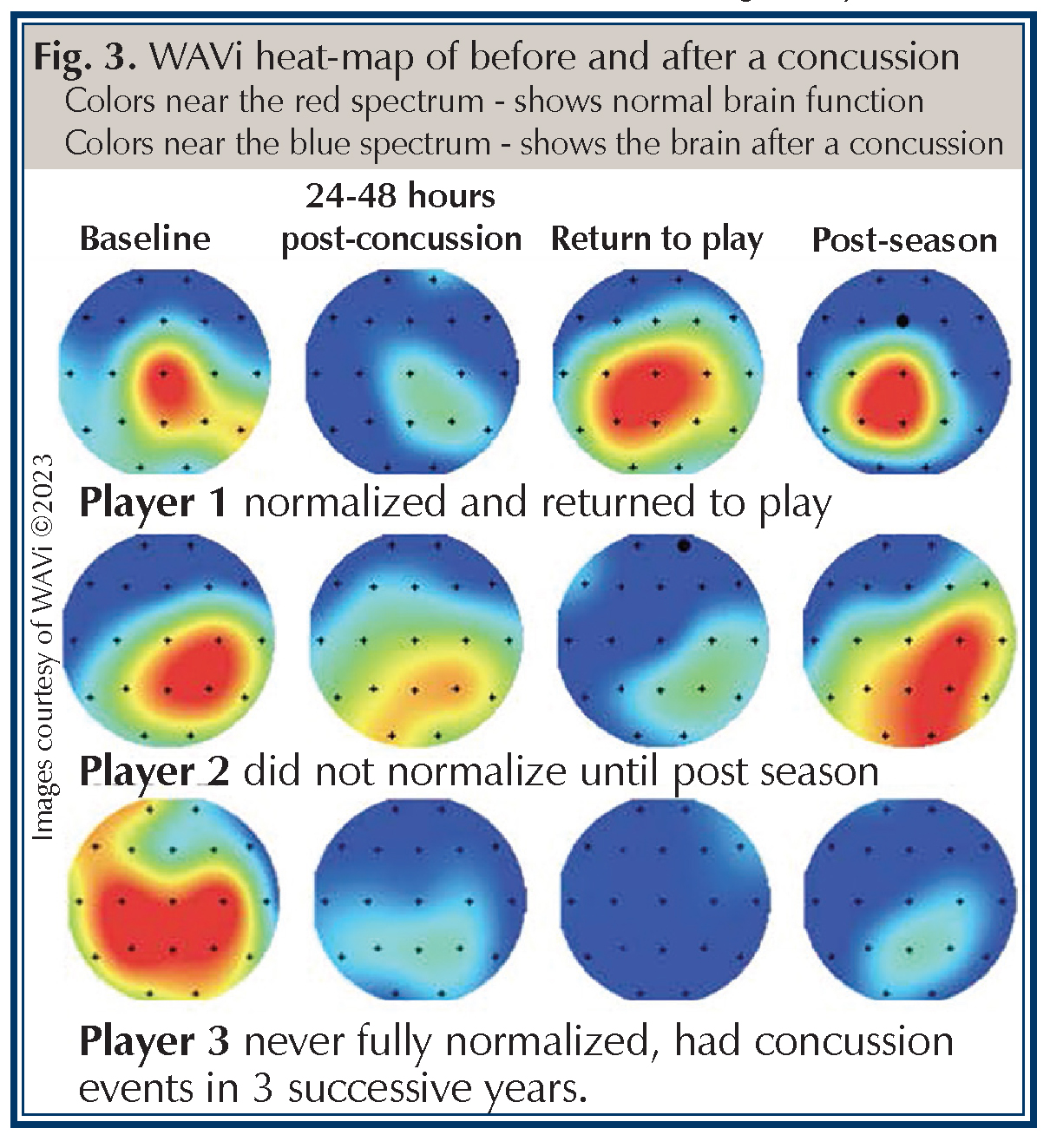 Concussion Software - Hughston Clinic