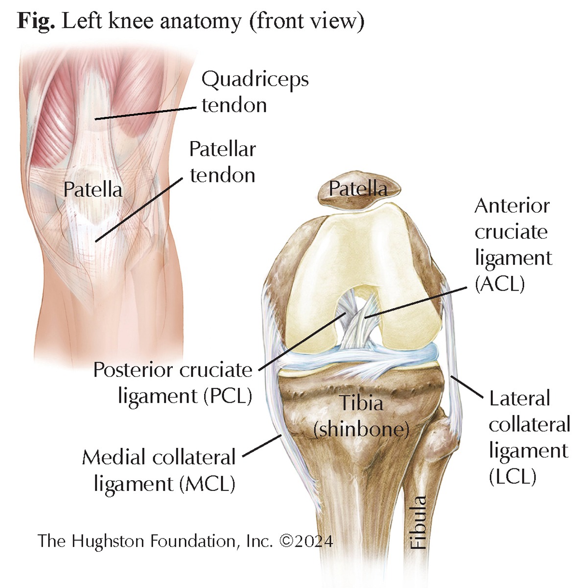 Quadriceps Tendon Autograft for ACL Reconstruction — The Cutting Edge
