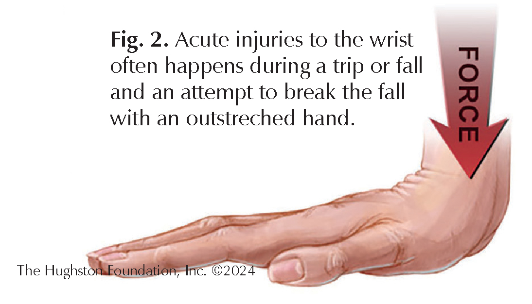 Pickleball Injuries - Hughston Clinic